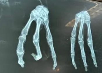 This Is Not A Hoax: New ‘extraterrestrial’ bodies from Peru have emerged