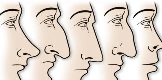 ZVUČI ČUDNO, ALI JE ISTINITO: Evo šta OBLIK NOSA govori O VAMA! Svima je pogodilo