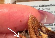 Jedan rez bio je dovoljan da se sve promijeni…