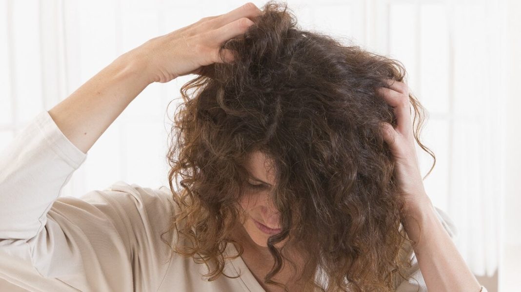 Prirodni saveznici protiv peruti: Šta zaista pomaže vašem vlasištu? Prirodni saveznici protiv peruti: Šta zaista pomaže vašem vlasištu?