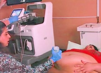 Trudna žena ima 226 kilograma i došla je na ultrazvuk, a onda je medicinska sestra podigla njen stomak i pogledala bolje… (VIDEO)