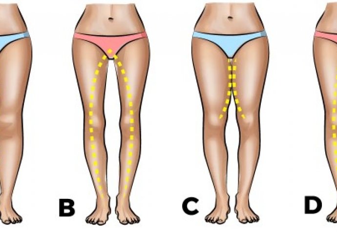 5e941562-5264-4309-8cd5-57c90a0a0a64-5a63978b-2310-4658-9d02-53390a0a0a67-noge1-690x480