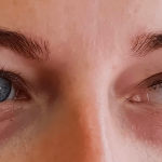 Natečeni kapci ujutro: Zašto se budimo s otečenim očima i kako to spriječiti