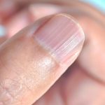 Ako imate ove linije na noktima nakon 40. godine, to je jasan znak da…