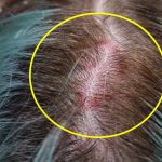 Kako pročitati etiketu šampona? Prva 3 sastojka su najvažnija, a jedna greška vas može koštati zdrave kose