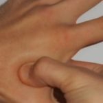 MASIRAJTE OVU TAČKU NA RUCI: Nestaje glavobolja, napetost u leđima, vratu i sinusima