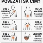 K0JI B0L P0VEZATI SA ČIM.. ŠTA VAŠ B0L G0V0RI 0 VAŠEM ZDRAVLJU