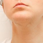 Ako ste žena s brkovima na bradi, onda obratite pažnju. Evo šta to znači