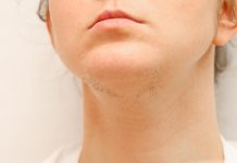 Ako ste žena s brkovima na bradi, onda obratite pažnju. Evo šta to znači