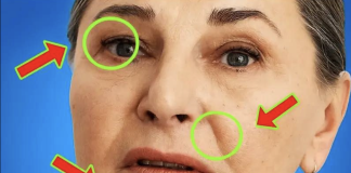 Svi koji imaju masnu jetru imaju ovo zajedničko: skriveni znak koji treba da znate