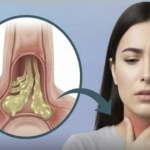 Kako ublažiti sluz u grlu: bezbedni i prirodni saveti za svakodnevno olakšanje