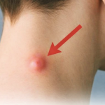 IMATE LI OVAKVU KVRŽICU IZA UHA? EVO ZAŠTO SE POJAVILA: Važno da znate