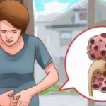 KADA SE POJAVE PROBLEMI S BUBREZIMA, VAŠ ORGANIZAM ŠALJE SLJEDEĆE SIGNALE: 6 SIMPTOMA KOJE NE BISTE TREBALI IGNORIRATI!