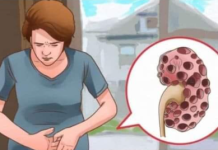 KADA SE POJAVE PROBLEMI S BUBREZIMA, VAŠ ORGANIZAM ŠALJE SLJEDEĆE SIGNALE: 6 SIMPTOMA KOJE NE BISTE TREBALI IGNORIRATI!