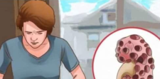 KADA SE POJAVE PROBLEMI S BUBREZIMA, VAŠ ORGANIZAM ŠALJE SLJEDEĆE SIGNALE: 6 SIMPTOMA KOJE NE BISTE TREBALI IGNORIRATI!