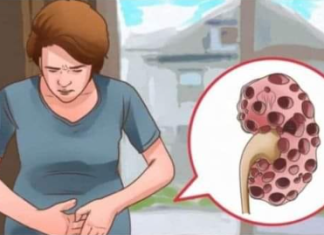 KADA SE POJAVE PROBLEMI S BUBREZIMA, VAŠ ORGANIZAM ŠALJE SLJEDEĆE SIGNALE: 6 SIMPTOMA KOJE NE BISTE TREBALI IGNORIRATI!