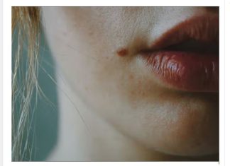 IMATE MLADEŽ IZ KOJEG RASTE DLAČICA-Evo šta to znači-Važno da znate