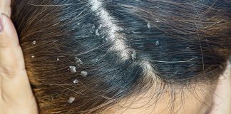 Imate li problema sa peruti? Ovo je najefikasnije rješenje za kojim su svi poludjeli!