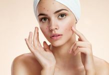 Mjesto prištića otkriva uzrok: Muči li vas probava ili hormoni