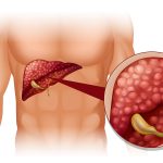 Doktor tvrdi: “Ako ovo jedete, vaša jetra je puna otrova”