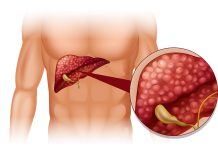 Doktor tvrdi: “Ako ovo jedete, vaša jetra je puna otrova”