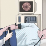 Ako vam ljekar naloži kolonoskopiju, jednostavno mu recite sljedeće…