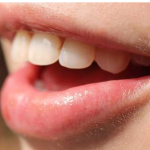 Krvarenje desni može biti znak da vam nedostaje jedna važna stvar