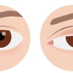 Spušteni kapak i nepodnošljiva glavobolja: Oprez, doktori upozoravaju na 2 alarmantna znaka opasnog stanja