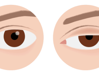 Spušteni kapak i nepodnošljiva glavobolja: Oprez, doktori upozoravaju na 2 alarmantna znaka opasnog stanja