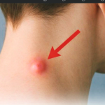 Ako vam se pojavi kvržica na vratu, leđima ili iza uha, to znači da…U ovom članku donosimo tri najčešće greške koje mnogi prave prilikom sadnje krompira, a koje mogu značajno uticati na prinos. U nastavku saznajte šta treba izbjegavati kako bi krompir rastao zdrav i dao bogatu berbu.