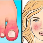 10 Znakova AUTOIMUNIH BOLESTI kod kojih tijelo samo sebe uništava