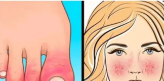 10 Znakova AUTOIMUNIH BOLESTI kod kojih tijelo samo sebe uništava