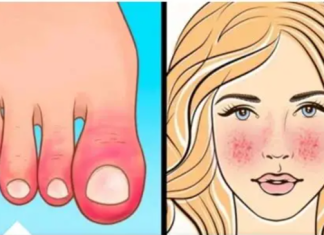 10 Znakova AUTOIMUNIH BOLESTI kod kojih tijelo samo sebe uništava