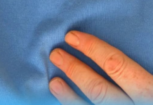 Doktorica upozorava: 90 posto srčanih udara povezano je s jednom jutarnjom navikom