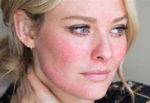 NA LICU JE SVE ZAPISANO: Evo kako pažljivim pregledom vašeg lica odmah možete uočiti sa čim imate ZDRAVSTVENIH PROBLEMA