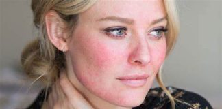 NA LICU JE SVE ZAPISANO: Evo kako pažljivim pregledom vašeg lica odmah možete uočiti sa čim imate ZDRAVSTVENIH PROBLEMA