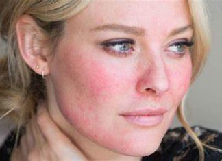 NA LICU JE SVE ZAPISANO: Evo kako pažljivim pregledom vašeg lica odmah možete uočiti sa čim imate ZDRAVSTVENIH PROBLEMA