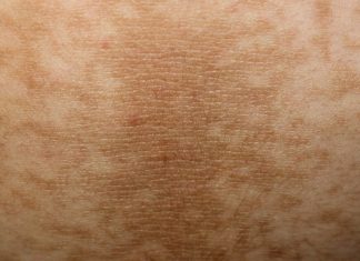 Simptomi DIJABETESA koji se javljaju i prije njegovog početka! 9 signala koje nikada ne biste trebali zanemariti