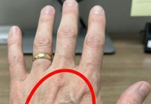 Ako imaš vidljive vene, to značI da si…