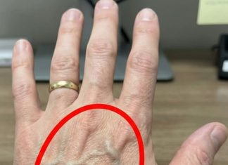 Ako imaš vidljive vene, to značI da si…