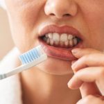 Desni vam često krvave? Nedostatak ovog vitamina može biti uzrok