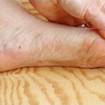 7 znakova da se tijelo već duže vrijeme bori s VISOKIM ŠEĆEROM U KRVI: Prvo ćete to primijetiti na očima i nogama!