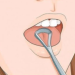 ODMAH POGLEDAJTE DA LI I VI IMATE OVO NA JEZIKU: To je znak da vam se dešavaju ove dvije stvari, PRVA VAM SE NIKAKO NEĆE DOPASTI