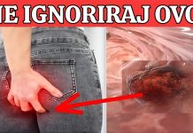 R@k debelog crijeva! UpozoravajućI znakovi I simptomi koje nikada ne smijete ignorirati.