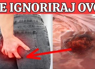 R@k debelog crijeva! UpozoravajućI znakovi I simptomi koje nikada ne smijete ignorirati.