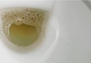 Vidite li mjehuriće u urinu? To može ukazivati na ozbiljnije zdravstveno stanje!