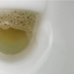 Vidite li mjehuriće u urinu? To može ukazivati na ozbiljnije zdravstveno stanje!