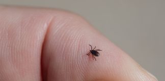 SA LEPIM VREMENOM STIŽU I KRPELJI! Evo kako bezbedno da ih izvadite kod kuće, jednu stvar nikako ne smete da radite